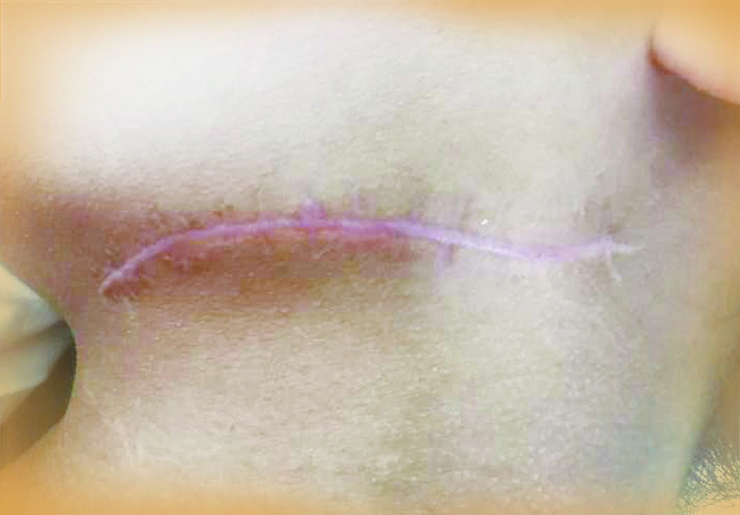 本报独家对话受害学生家长“治疗费无人管”